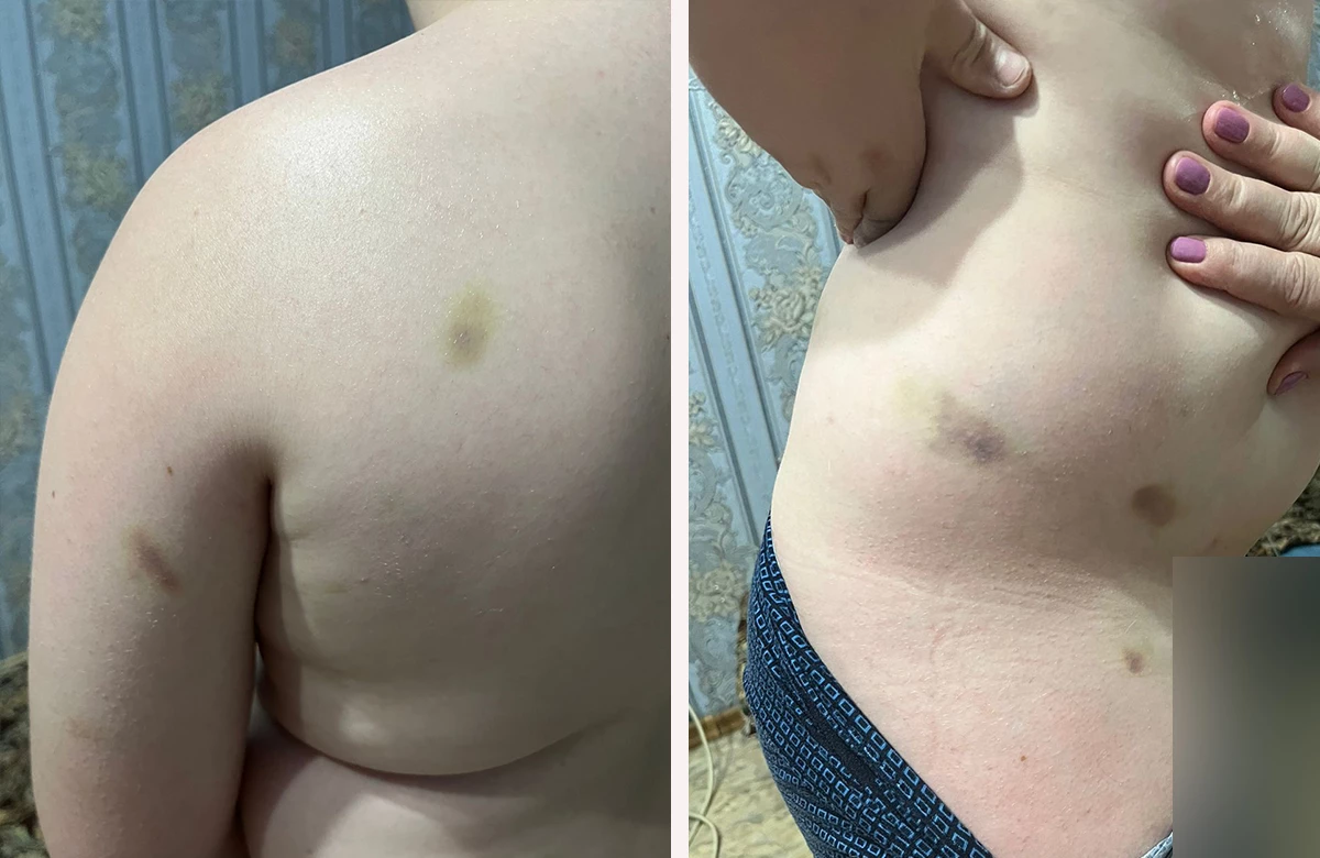 10-летнего ребенка избили в Уральска